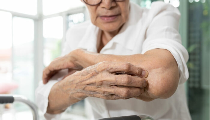 Itchy Skin in Seniors &#8211; Causes, Symptoms, and Management