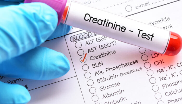 How to Analyze a Creatinine Level Chart