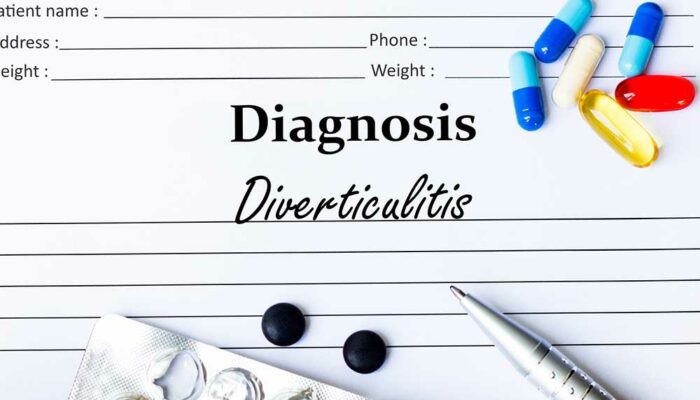 7 Probiotic-Rich Foods to Try When Dealing with Diverticulitis